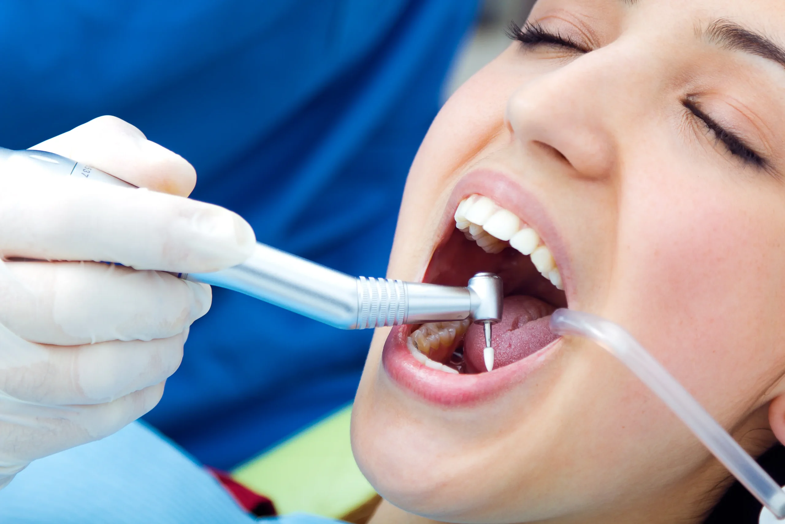 restorative dental treatment at Mission Dental in Carmichael.