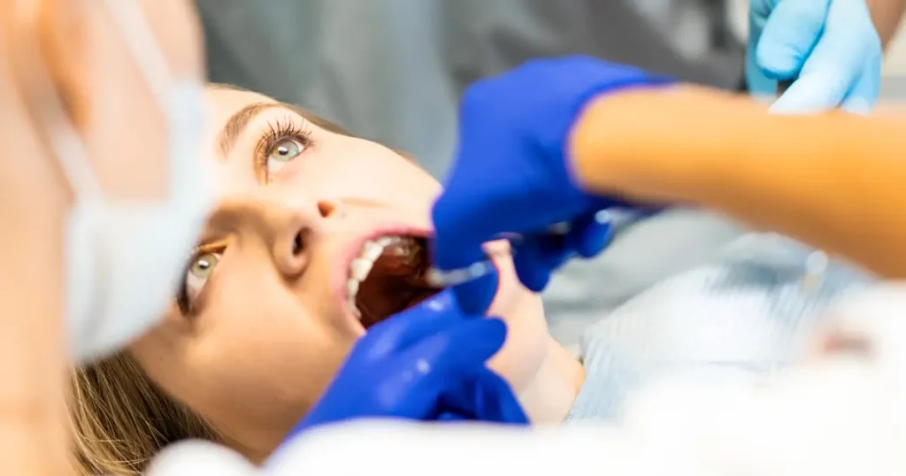 Tooth Extraction in Carmichael, CA 95608 — When It's Necessary and What to Expect 3 tooth extraction Carmichael CA 95608 at Mission Dental